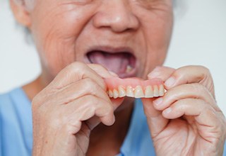 A woman who’s just removed her denture