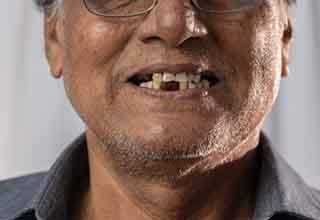 Man has missing teeth