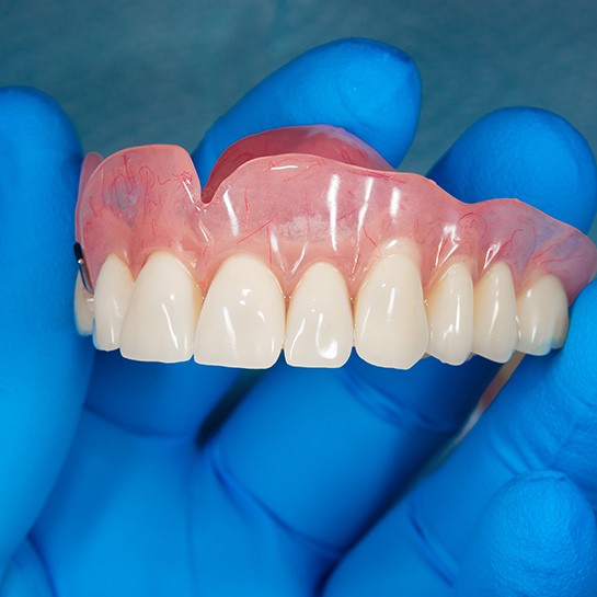 Closeup of a set of dentures being held by a blue-gloved hand