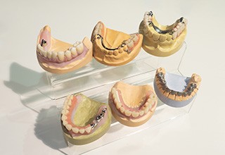 6 sets of dentures on plaster molds on a clear holder with a neutral background