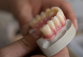 Closeup of a lab tech shaping the gums on a set of dentures on a cast